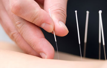 Acupuncture Westminster Colorado